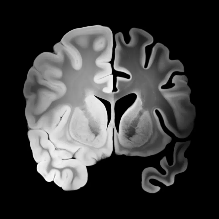 Biais cognitifs en marketing : guide complet